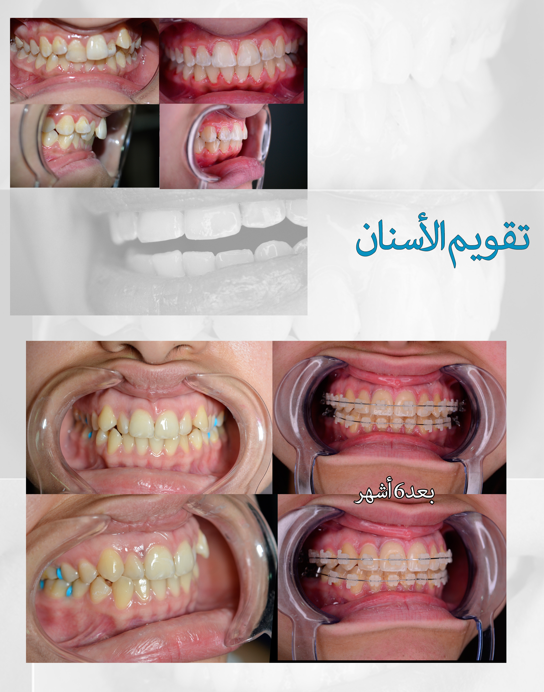 Advanced Dental Care for Treatment & Cosmetic Dentistry